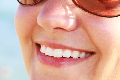 teeth-whitening-optimizing-your-smile