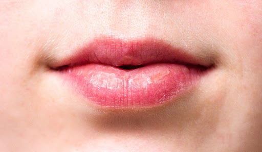 xerostomia-ways-to-get-rid-of-dry-mouth